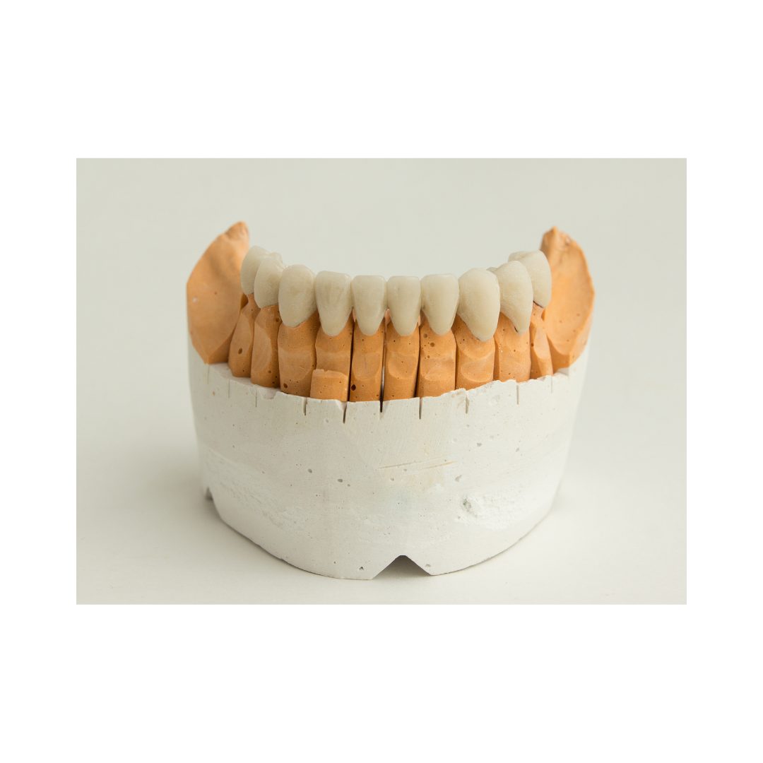 Porcelain Crowns And Veneers