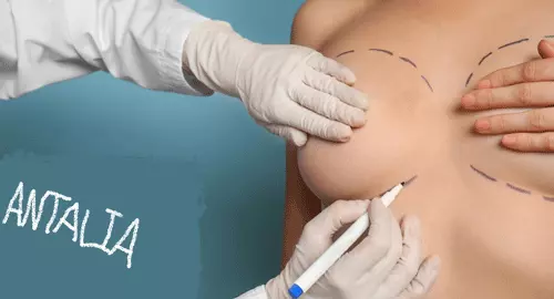 Nipple and Areola Reduction