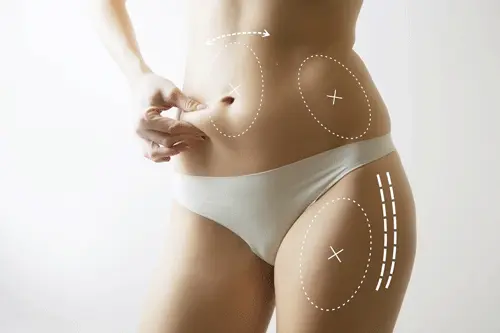 Is a tummy tuck safe in turkey