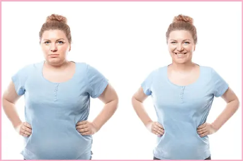 gastric sleeve pros and cons
