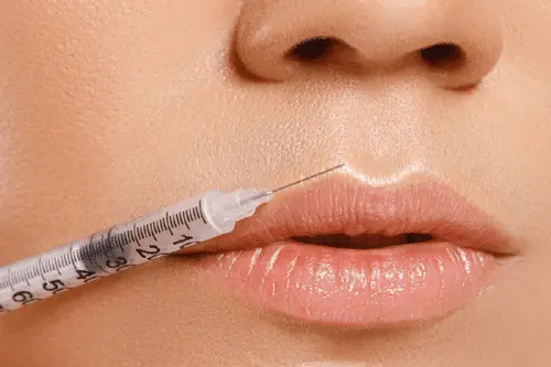 pros and cons of lip fillers in antalya