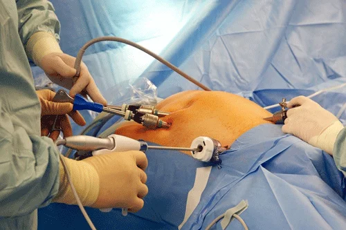 جراحی چاقی در آنتالیا