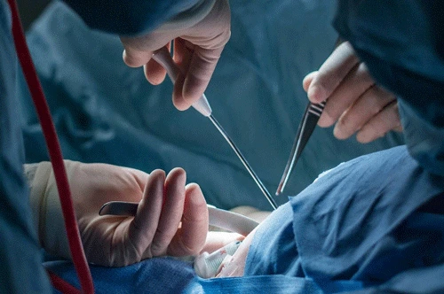 جراحات تجميل الأعضاء التناسلية في أنطاليا