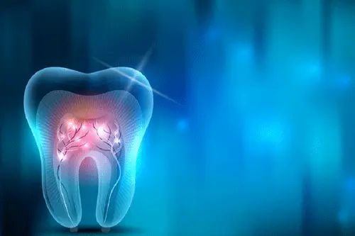 درمان ریشه دندان در آنتالیا