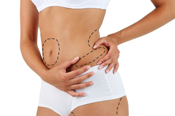 Is liposuction painful
