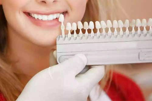 دندانپزشکی زیبایی در ترکیه