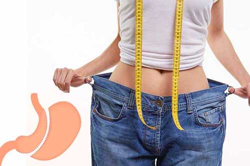 Gastric Sleeve Cost in Turkey