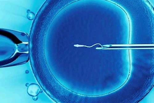 IVF Treatment in Antalya