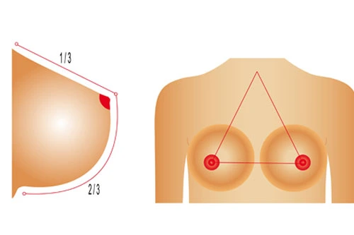 Breast Reduction Surgery turkey