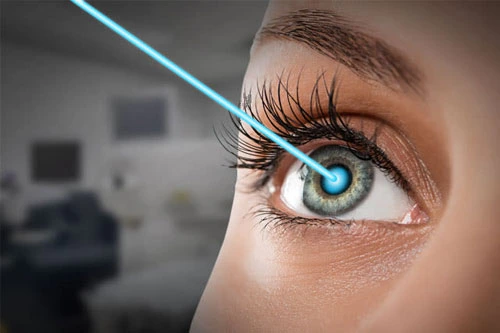 قیمت جراحی لیزر چشم در ترکیه