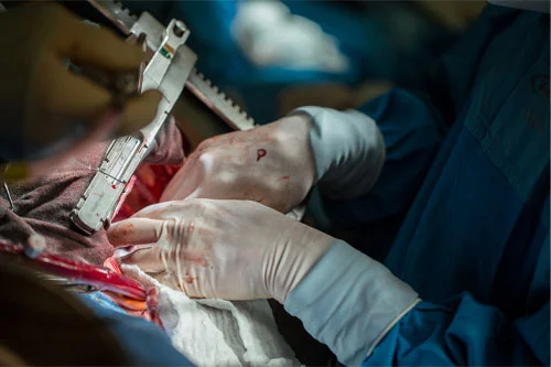 هزینه جراحی قلب در ترکیه