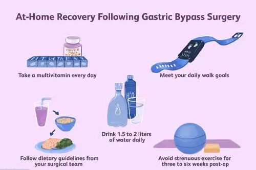 gastric bypass surgery recovery