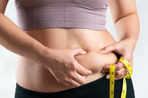 Managing Loose Skin Post-Weight Loss surgery