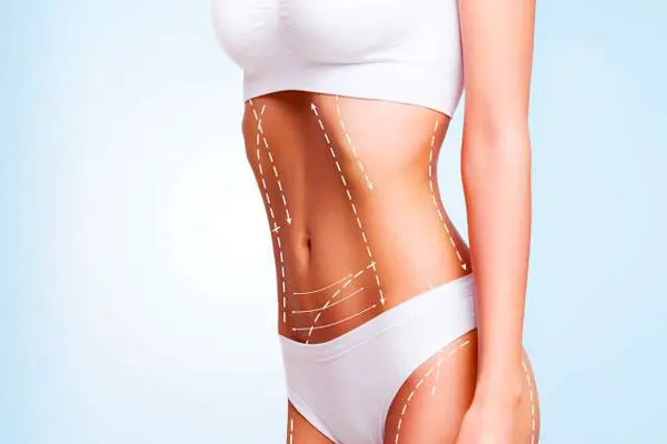 Affordable Plastic Surgery in Antalya