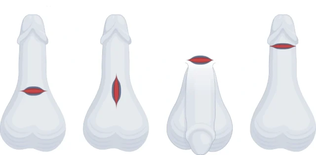 Temporary Penis Enlargement Methods