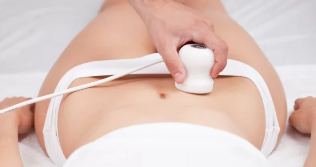 Cryolipolysis: Freezing Fat Cells to Sculpt Your Body