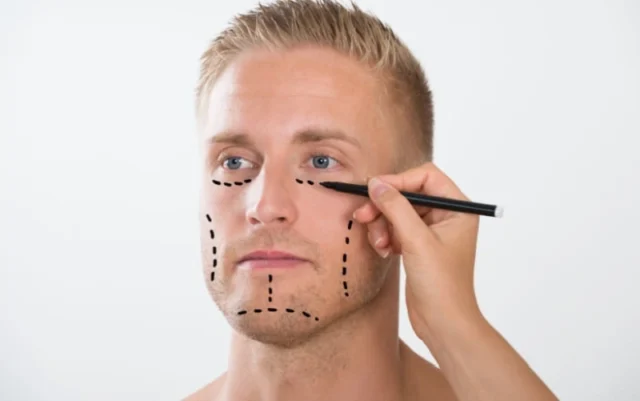 Common procedures in men's aesthetic surgery