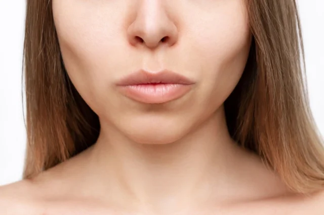 Reasons for the Growing Popularity of Buccal Fat Removal