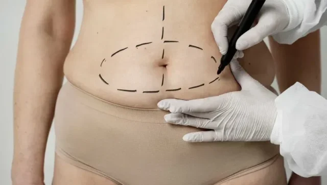 Evaluating the Risks Associated with Weight Loss Surgery