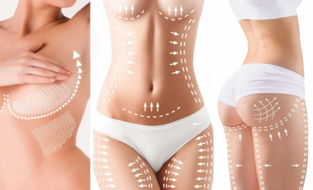 Mommy Makeover with Medgol: The Ultimate Transformation in Turkey