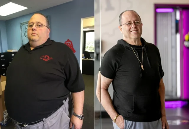 Understanding Weight Loss Surgery and Its Impact on Diet