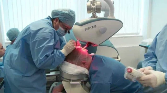 How Robotic Hair Transplants Work