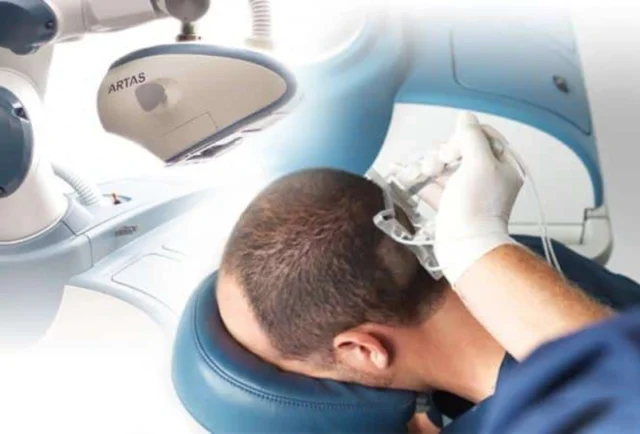 Cost Analysis: Robotic vs. Traditional Hair Transplants