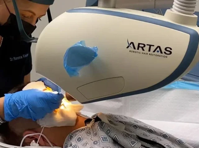 What is Robotic Hair Transplantation?