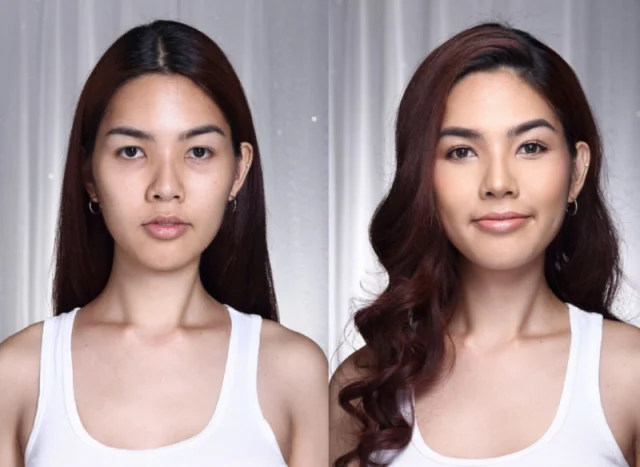 Recovery and Aftercare: A Smooth Transition to Your Feminine Look