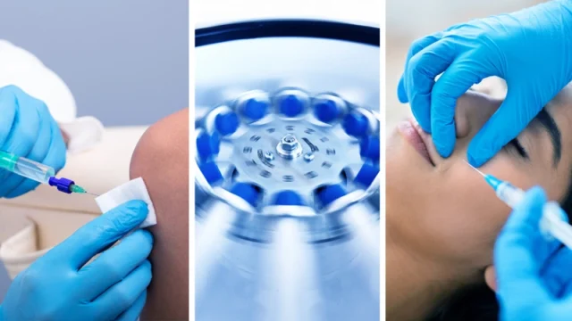 Applications of Stem Cell Therapy in Regenerative Medicine