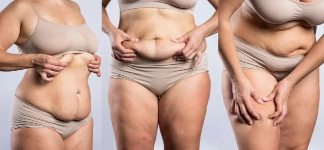 Popular Cosmetic Procedures Offered in Turkey