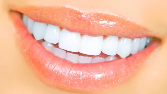 Popular Cosmetic Dentistry Procedures in Turkey