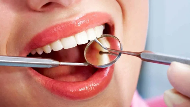 Popular Dental Procedures Among International Patients