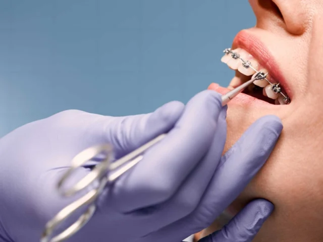 Comparison of Dental Prices: Turkey vs. Western Countries
